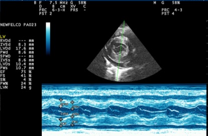 Thickened ventricle walls in a cat with cardiomyopathy