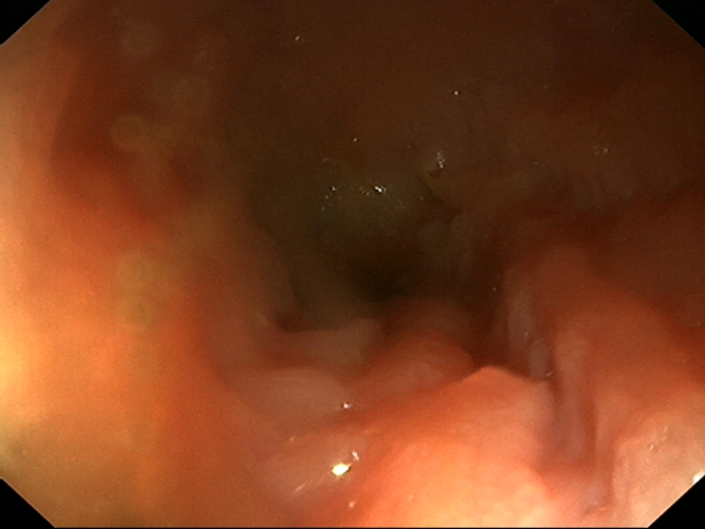 Intestines from dog with inflammatory bowel disease